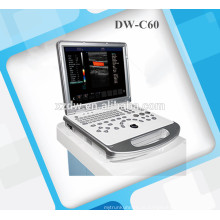 scanner de ultrassonografia doppler ecógrafo portátil e doppler DW-C60